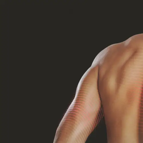04_Muscle-Treatments